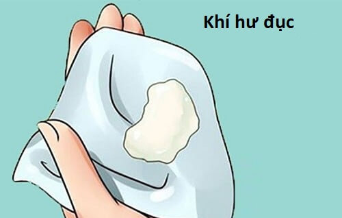 Khí hư đục